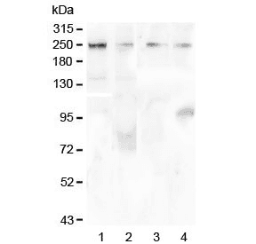 TRPM7 Antibody