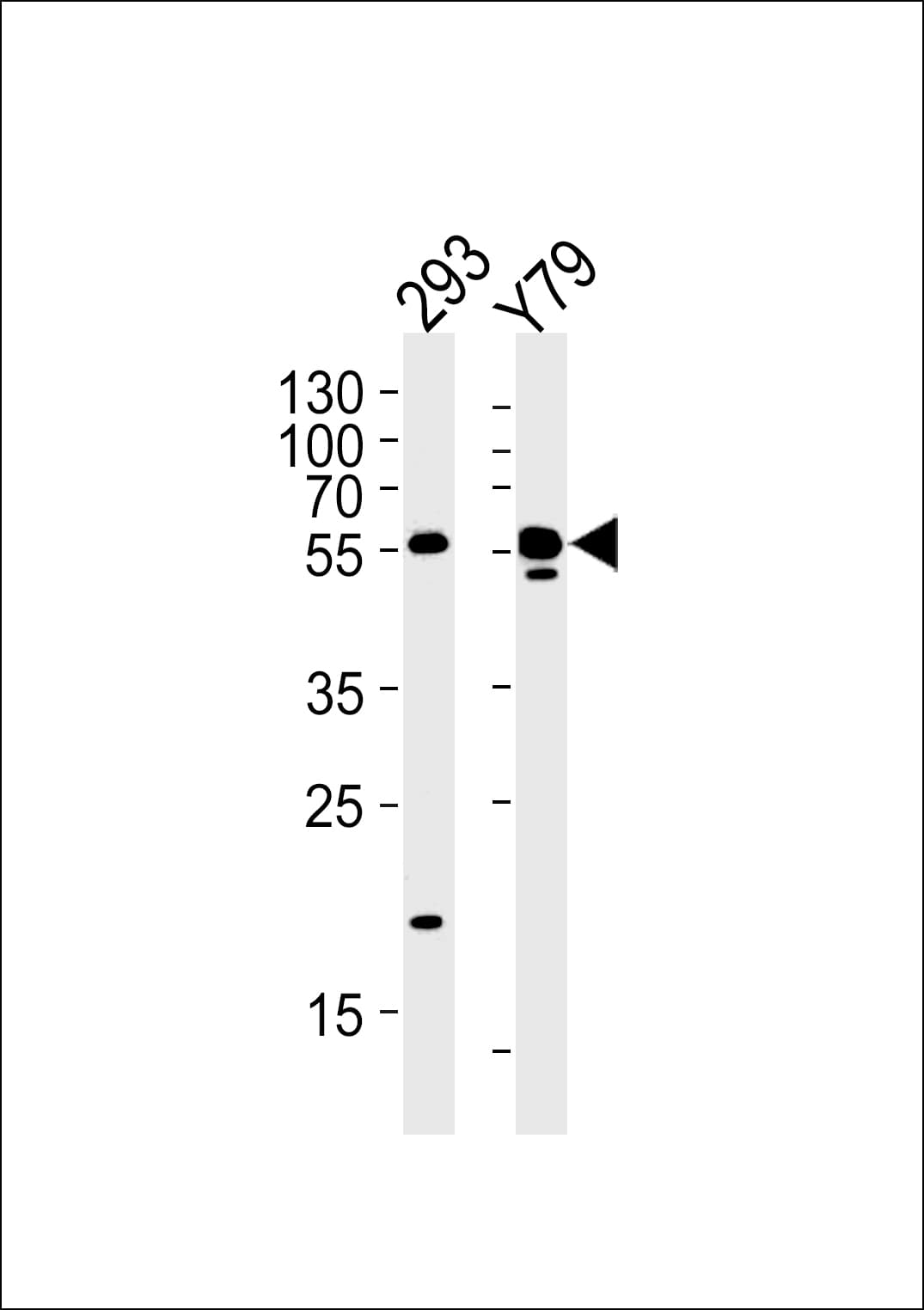 Polyclonal Rabbit anti-Human ALDH1A3 Antibody (aa24-51, IHC, WB)