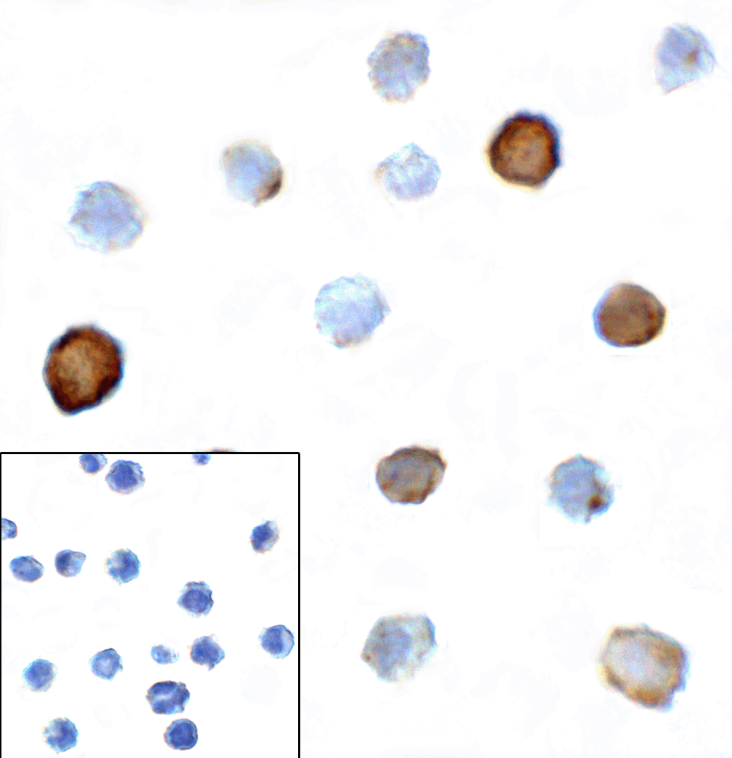 IHC-plus™ TIGIT Antibody (clone 3B5)