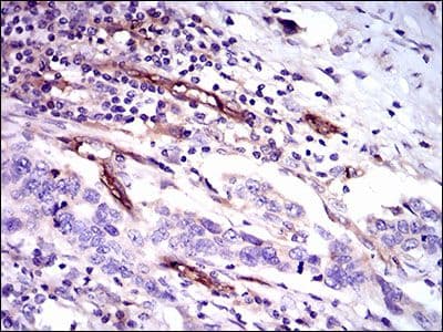 CD59 Antibody (Amino Acid: 31-111, clone 8D2B8)