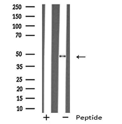 GHRHR Antibody