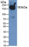 PZP Antibody (aa1224-1495)