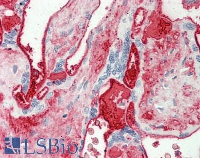 IHC-plus™ FGB / Fibrinogen Beta Chain Antibody