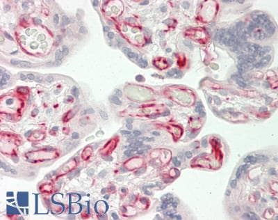 IHC-plus™ SYNE3 / C14orf49 Antibody (Internal)