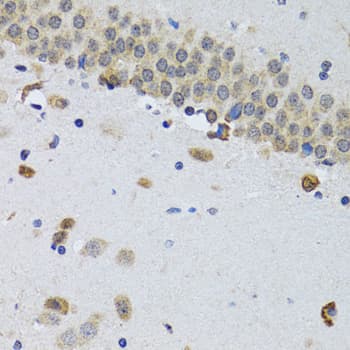 Polyclonal Rabbit anti-Human CIRP / CIRBP Antibody (IHC, IF, WB)
