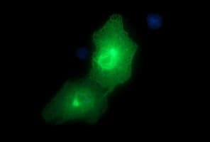 Monoclonal Mouse anti-Human EPCAM Antibody (clone OTI2B8, IF, WB)