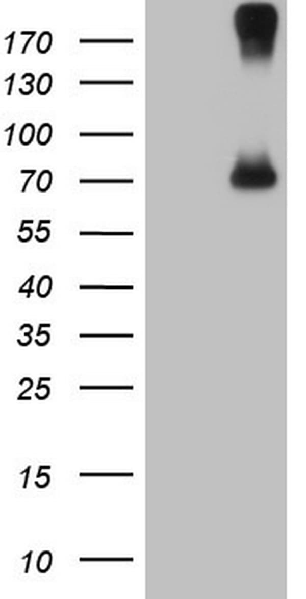 CFI / Complement Factor I Antibody (aa340-583, clone OTI6F9)