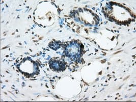 ERCC1 Antibody (clone OTI2A7)