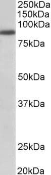 FGFR1 / FGF Receptor 1 Antibody (aa87-98)