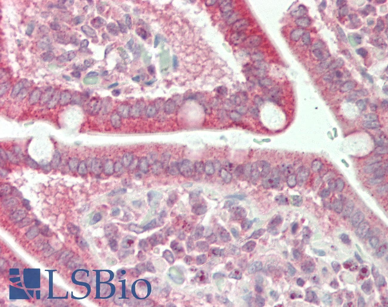 IHC-plus™ Polyclonal Rabbit anti-Human AIRE Antibody (IHC, IF, WB)