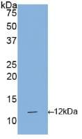 IL1R1 Antibody (aa21-109)