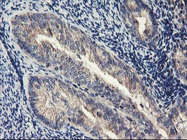 PDSS2 / DLP1 Antibody (clone OTI2A3, Carrier-free)