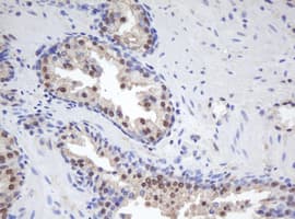 MORF4 Antibody (aa1-255, clone OTI1B12, Carrier-free)