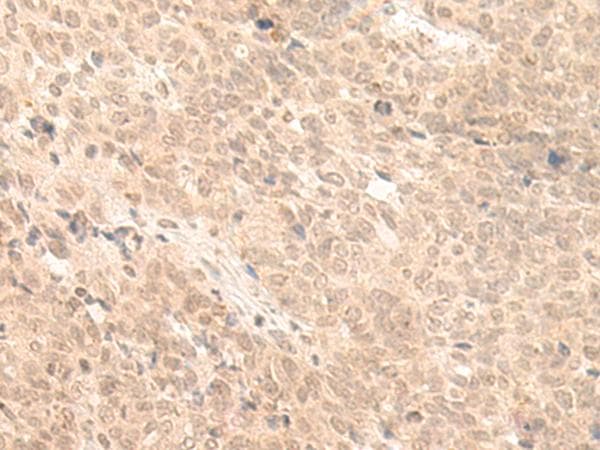 FABP4 / AP2 Antibody