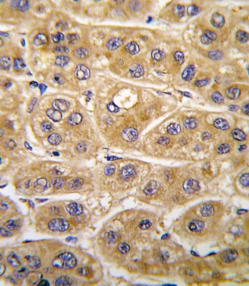 Polyclonal Rabbit anti-Human AGT / Angiotensinogen Antibody (aa418-450, IHC, WB)