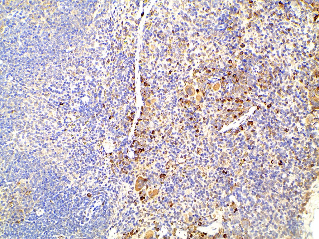 EFNB2 / Ephrin B2 Antibody