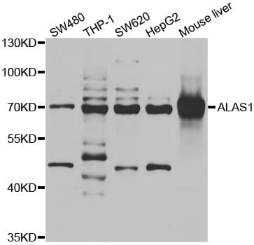 Polyclonal Rabbit anti-Human ALAS1 Antibody (aa1-250, IHC, IF, WB)