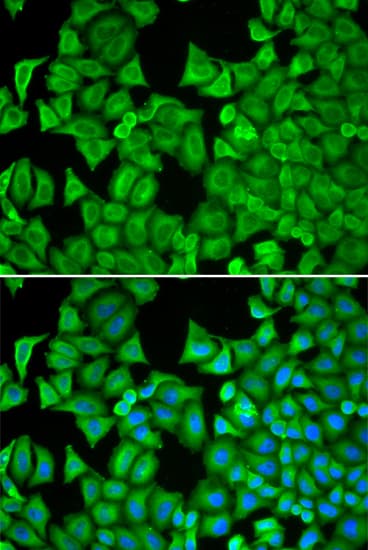 R1 / RRM1 Antibody
