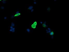 Monoclonal Mouse anti-Human MAP2K3 / MEK3 / MKK3 Antibody (clone OTI5C11, IF, WB)