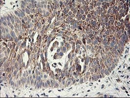 MTFMT Antibody (aa175-389, clone OTI1C1)