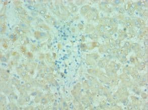 BIRC2 / cIAP1 Antibody (aa1-300)