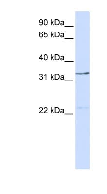 GTF2E2 Antibody (C-Terminus)