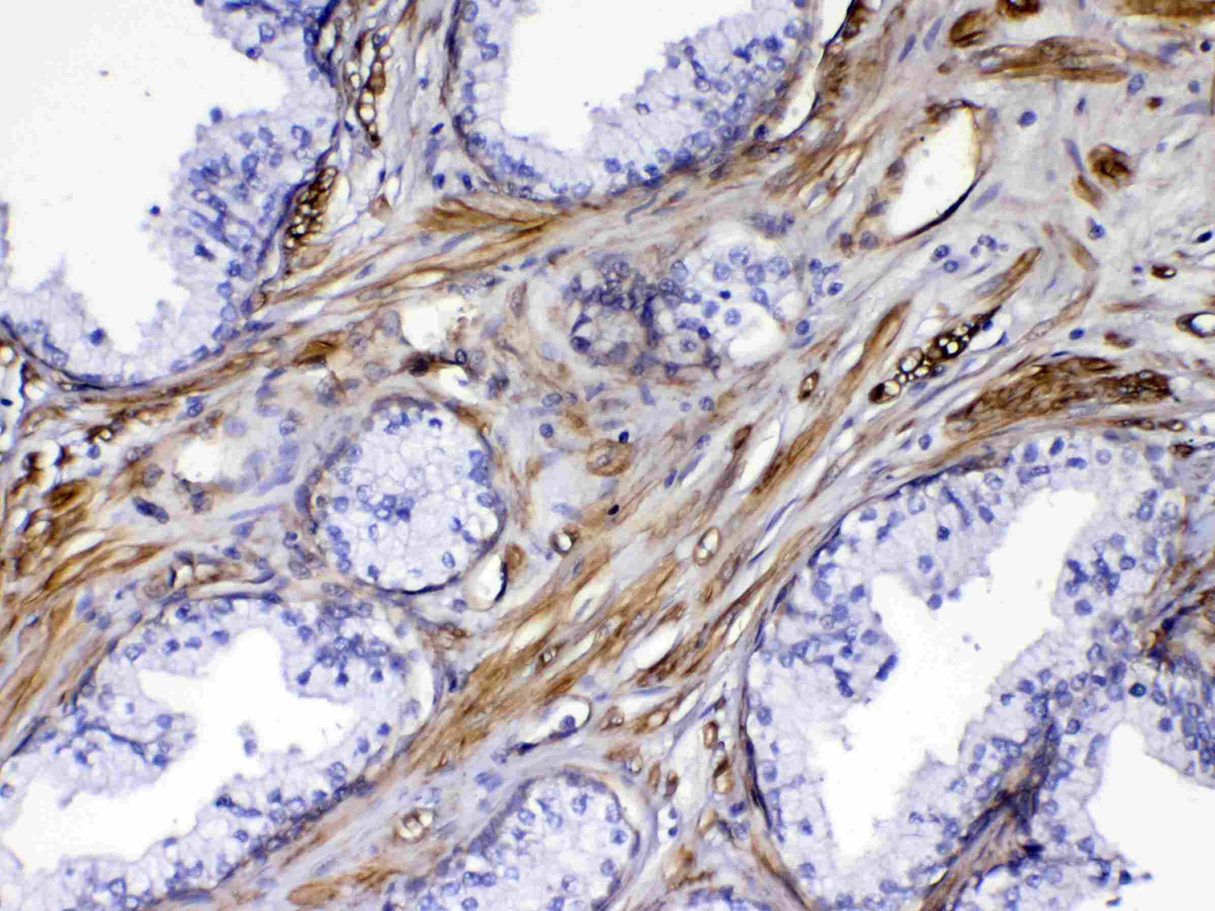 Polyclonal Rabbit anti-Human FLT4 / VEGFR3 Antibody (IHC, WB)