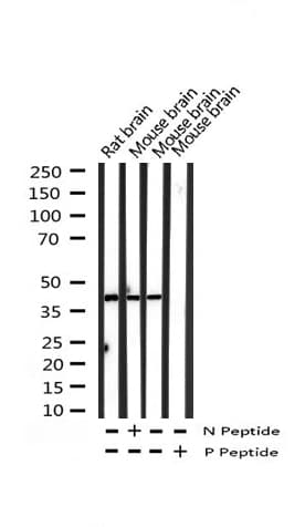 SYT1 / Synaptotagmin Antibody (phospho-Ser309)