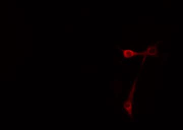 Polyclonal Rabbit anti-Human CD44 Antibody (phospho-Ser706, IF, WB)