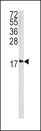 Polyclonal Rabbit anti-Human CAV3 / Caveolin 3 Antibody (aa5-31, IHC, WB)
