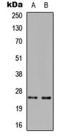 TNFSF14 / LIGHT Antibody (Internal)