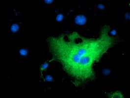 L1CAM Antibody (clone OTI2G9)