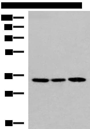 Polyclonal Rabbit anti-Human SOX2 Antibody (IHC, WB)