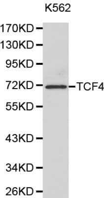 Polyclonal Rabbit anti-Human TCF4 Antibody (IHC, WB)
