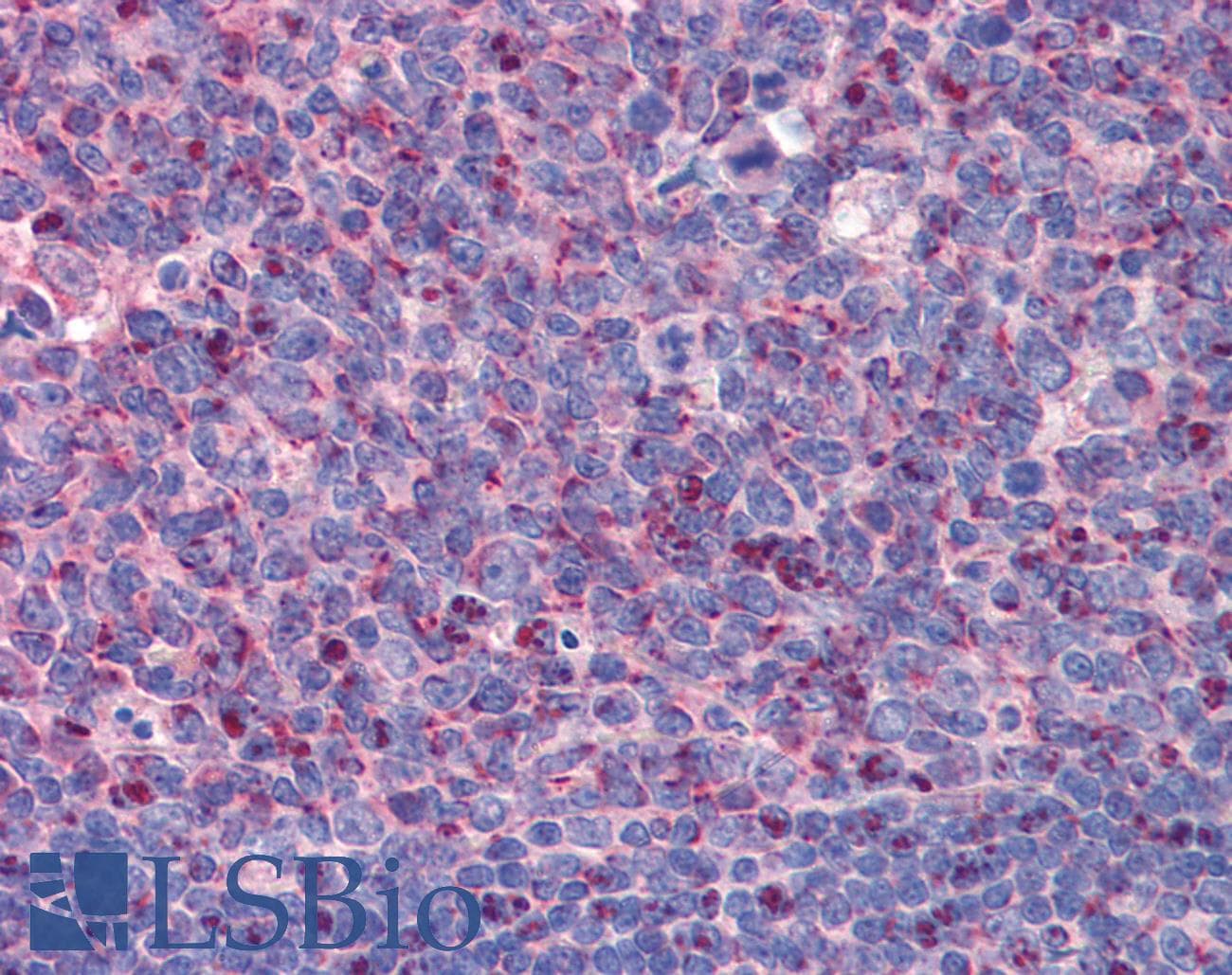 Polyclonal Rabbit anti-Human IMP3 Antibody (C-Terminus, IHC, WB)