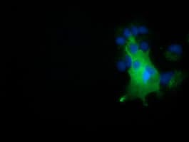 Monoclonal Mouse anti-Human NUMB Antibody (clone OTI1A7, IF, WB)