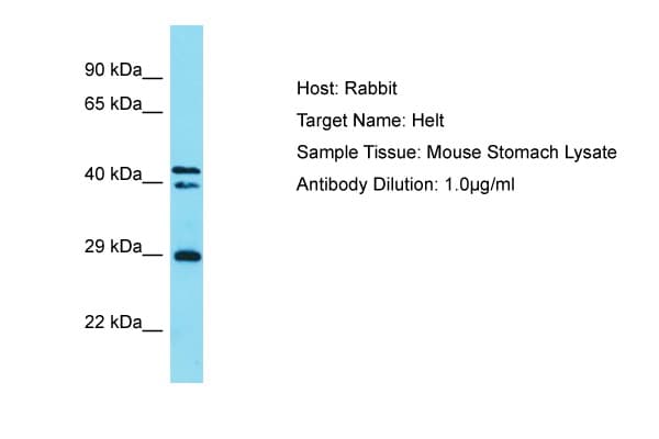 HELT Antibody (aa138-187)