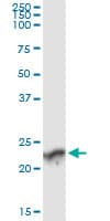 GUK1 / Guanylate Kinase 1 Antibody (clone 4C3-1A7)