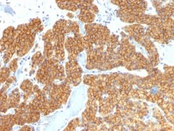 PTH / Parathyroid Hormone Antibody (N-Terminus, clone PTH/911, Ready-to-Use)