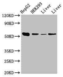 IHC-plus™ MAP2K5 / MEK5 Antibody