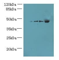 Polyclonal Rabbit anti-Human GHITM Antibody (IHC, WB)