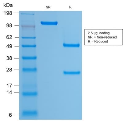 HPV16 L1 Antibody (clone rHPV16L1/1058)