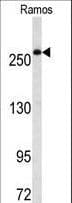 IHC-plus™ Polyclonal Rabbit anti-Human FASN / Fatty Acid Synthase Antibody (aa942-973, IHC, IF, WB)