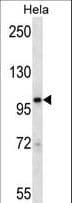 STAT2 Antibody (aa186-215)