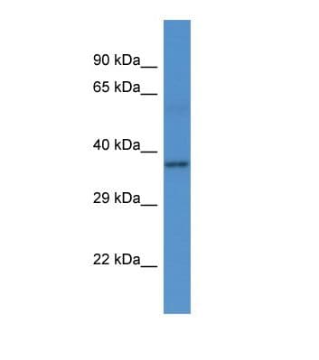 RPH3A / Rabphilin 3A Antibody (C-Terminus)
