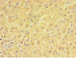 Polyclonal Rabbit anti-Human ADGRE1 / EMR1 Antibody (aa21-290, IHC)