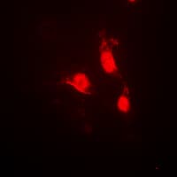 CAMK4 / CaMK IV Antibody (phospho-Thr200)
