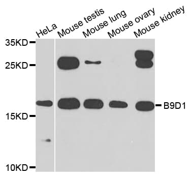 B9D1 Antibody