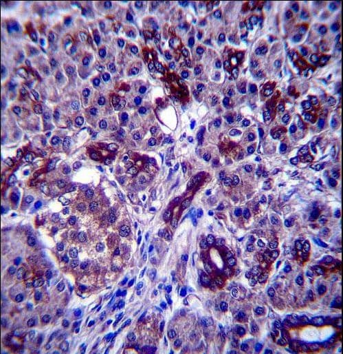 PPP1R3F Antibody (aa549-578)