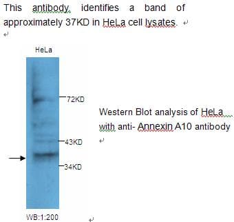 Polyclonal Rabbit anti-Human ANXA10 / Annexin A10 Antibody (WB)
